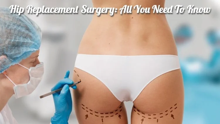 Hip Replacement Surgery: All You Need to Know